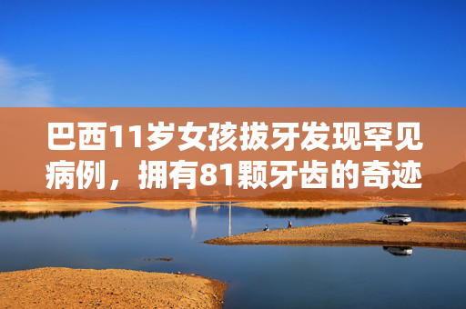 巴西11岁女孩拔牙发现罕见病例，拥有81颗牙齿的奇迹